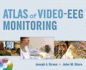 Atlas of Video-Eeg Monitoring