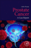 Prostate Cancer: a Case Report