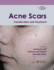Acne Scars Classification and Treatment 2ed (Hb 2019)