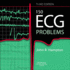 The Ecg in Practice