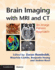 Brain Imaging With Mri and Ct: an Image Pattern Approach