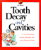 Tooth Decay & Cavities