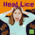 Head Lice (First Facts)