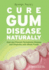 Cure Gum Disease Naturally: Heal and Prevent Periodontal Disease and Gingivitis With Whole Foods