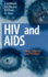 Hiv and Aids: Basic Elements and Priorities