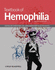 Textbook of Hemophilia