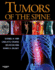 Tumors of the Spine (Hb 2008)