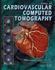 Atlas of Cardiovascular Computed Tomography: Includes Narrated Videos