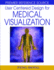 User Centered Design for Medical Visualization