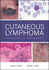 Cutaneous Lymphoma