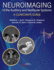 Neuroimaging of the Auditory and Vestibular Systems: A Clinician's Guide