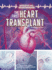 The First Heart Transplant Format: Paperback