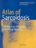 An Atlas of Sarcoidosis