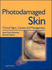 Photodamaged Skin: Clinical Signs, Causes and Management