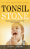 Tonsil Stones: the Truth About Tonsil Stones (Eliminate Tonsil Stones and Have Fresh Breath in Just Days! )