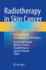 Radiotherapy in Skin Cancer: a Practical Guide on Indications and Techniques