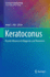 Keratoconus