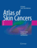 Atlas of Skin Cancers: Practical Guide to Diagnosis and Treatment