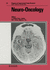 Clifford Rose Progress in Experimental Tumor Resea Rch-*Neuro-Oncology*: Mansell Bequest Symposium on Advances in Neuro-Oncology, London, October 1984: Proceedings: 29 (Progress in Tumor Research)