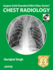 Jaypee Gold Standard Mini Atlas Series: Chest Radiology