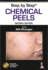 Step by Step: Chemical Peels