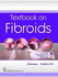 Textbook on Fibroids (Pb 2018)