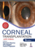 Corneal Transplantation: with Videos