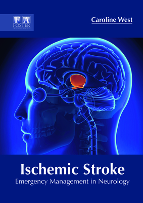 Ischemic Stroke: Emergency Management in Neurology - West, Caroline (Editor)