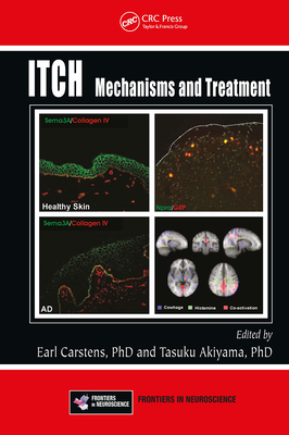 Itch: Mechanisms and Treatment - Carstens, E (Editor), and Akiyama, Tasuku (Editor)