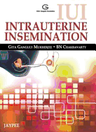 IUI Intrauterine Insemination
