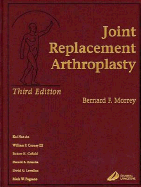 Joint Replacement Arthroplasty - Morrey, Bernard F, MD