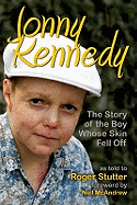 Jonny Kennedy: The Story of the Boy Whose Skin Fell Off