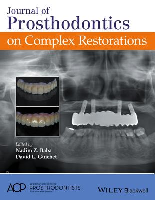 Journal of Prosthodontics on Complex Restorations - Baba, Nadim Z (Editor), and Guichet, David L (Editor)