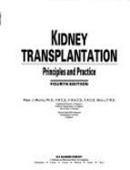 Kidney Transplantation