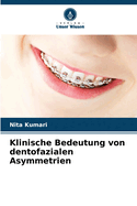 Klinische Bedeutung von dentofazialen Asymmetrien