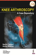 Knee Arthroscopy: A Case Repository