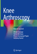 Knee Arthroscopy: How to Succeed