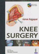 Knee Surgery