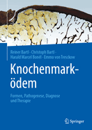 Knochenmarkdem: Formen, Pathogenese, Diagnose Und Therapie