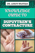 Knowledge Guide to Dupuytren's Contracture: Comprehensive Manual To Symptoms, Treatments, And Preventative Care For Hand Health And Mobility