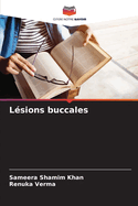 L?sions buccales