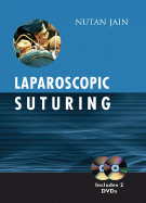 Laparoscopic Suturing