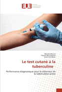 Le test cutan? ? la tuberculine