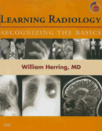 Learning Radiology: Recognizing the Basics (with Student Consult Online Access)