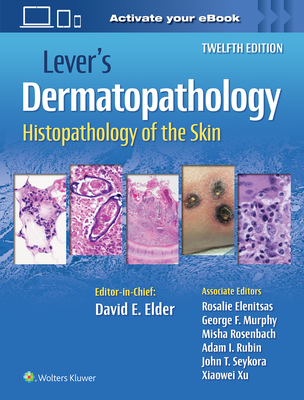 Lever's Dermatopathology: Histopathology of the Skin - Elder, David E, MB, Chb