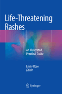 Life-Threatening Rashes: An Illustrated, Practical Guide