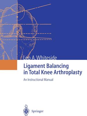 Ligament Balancing in Total Knee Arthroplasty: An Instructional Manual - Whiteside, Leo A