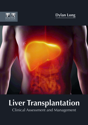 Liver Transplantation: Clinical Assessment and Management - Long, Dylan (Editor)