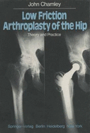 Low Friction Arthroplasty of the Hip: Theory and Practice