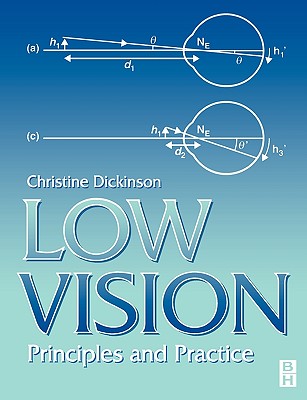 Low Vision: Principles and Practice - Dickinson, Christine